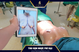 thu-gon-nguc-phi-dai-thammyjobeauty.com